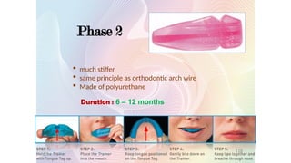 Phase 2
Duration : 6 – 12 months
 much stiffer
 same principle as orthodontic arch wire
 Made of polyurethane
118
 