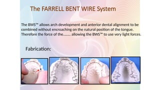 The FARRELL BENT WIRE System
The BWS™ allows arch development and anterior dental alignment to be
combined without encroaching on the natural position of the tongue.
Therefore the force of the…….. allowing the BWS™ to use very light forces.
Fabrication:
 