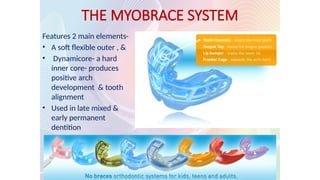 THE MYOBRACE SYSTEM
Features 2 main elements-
• A soft flexible outer , &
• Dynamicore- a hard
inner core- produces
positive arch
development & tooth
alignment
• Used in late mixed &
early permanent
dentition
 
