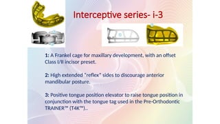 Interceptive series- i-3
1: A Frankel cage for maxillary development, with an offset
Class I/II incisor preset.
2: High extended “reflex” sides to discourage anterior
mandibular posture.
3: Positive tongue position elevator to raise tongue position in
conjunction with the tongue tag used in the Pre-Orthodontic
TRAINER™ (T4K™)..
 