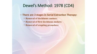 Dewel’s Method: 1978 (CD4)
– There are 3 stages in Serial Extraction Therapy:
• Removal of deciduous canines:
• Removal of first deciduous molars:
• Removal of erupting premolars:
 