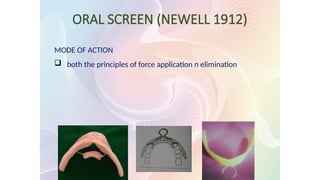 ORAL SCREEN (NEWELL 1912)
MODE OF ACTION
 both the principles of force application n elimination
 
