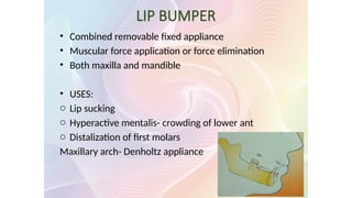LIP BUMPER
• Combined removable fixed appliance
• Muscular force application or force elimination
• Both maxilla and mandible
• USES:
o Lip sucking
o Hyperactive mentalis- crowding of lower ant
o Distalization of first molars
Maxillary arch- Denholtz appliance
 