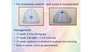 • For transverse control - Jack screw is incorporated
Management:
• 1st
week: 2-3 hrs during day
• 2nd
week: full night + 1-3 hr each day
• 3rd
week: appliance is checked to evaluate the trimming
• Every 6 weeek: check up appointment
 