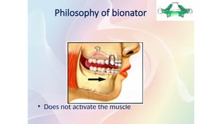 Philosophy of bionator
• Does not activate the muscle
 