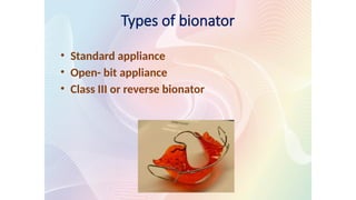Types of bionator
• Standard appliance
• Open- bit appliance
• Class III or reverse bionator
 