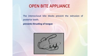 OPEN BITE APPLIANCE
• The interocclusal bite blocks prevent the extrusion of
posterior teeth.
• prevents thrusting of tongue
 