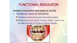 FUNCTIONAL REGULATOR
FRANKEL’S PHILOSOPHY AND MODE OF ACTION
1. VESTIBULAR ARENA OF OPERATION
Dentition is influenced by peri-oral muscle function.
Abnormal peri-oral muscle function creates a barrier for
the optimal growth of the dento-alveolar complex.
 