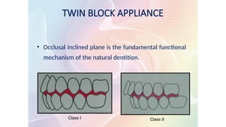 TWIN BLOCK APPLIANCE
• Occlusal inclined plane is the fundamental functional
mechanism of the natural dentition.
Class I Class II
 