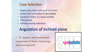 Case Selection
• Angles class II div I with good arch form
• Arches that uncrowded or decrowded
• overjet10-12mm & a deep overbite
• VTO positive
• Actively growing individual
Angulation of inclined plane
• 70 degree- more horizontal
component of force- encourage
fwd mand growth
 