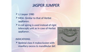 JASPER JUMPER
 J.J Jasper 1980
 MOA -Similar to that of Herbst
appliance.
 A coil spring is used instead of rigid
telescopic unit as in case of Herbst
appliance .
INDICATIONS:
 Skeletal class II malocclusion with
maxillary excess & mandibular def.
 