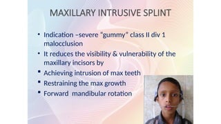 MAXILLARY INTRUSIVE SPLINT
• Indication –severe “gummy” class II div 1
malocclusion
• It reduces the visibility & vulnerability of the
maxillary incisors by
 Achieving intrusion of max teeth
 Restraining the max growth
 Forward mandibular rotation
 
