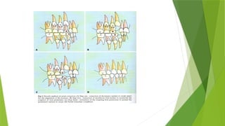 Interceptive Definition interceptive orthodontic.pptxbdjdhdvdjdjdbdvrbf | PPTX