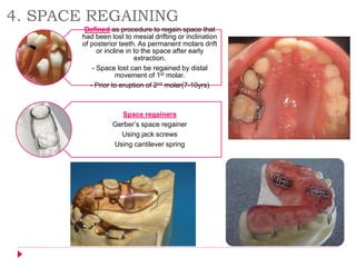 4. SPACE REGAINING
Defined as procedure to regain space that
had been lost to mesial drifting or inclination
of posterior teeth. As permanent molars drift
or incline in to the space after early
extraction.
- Space lost can be regained by distal
movement of 1st molar.
- Prior to eruption of 2nd molar(7-10yrs)
Space regainers
Gerber’s space regainer
Using jack screws
Using cantilever spring
 