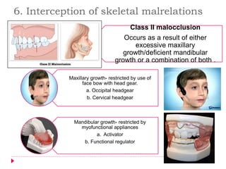 Class II malocclusion
Occurs as a result of either
excessive maxillary
growth/deficient mandibular
growth or a combination of both .
6. Interception of skeletal malrelations
Maxillary growth- restricted by use of
face bow with head gear.
a. Occipital headgear
b. Cervical headgear
Mandibular growth- restricted by
myofunctional appliances
a. Activator
b. Functional regulator
 