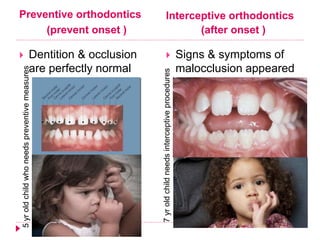Preventive orthodontics
(prevent onset )
Interceptive orthodontics
(after onset )
 Dentition & occlusion
are perfectly normal
 Signs & symptoms of
malocclusion appeared
5yroldchildwhoneedspreventivemeasures
7yroldchildneedsinterceptiveprocedures
 