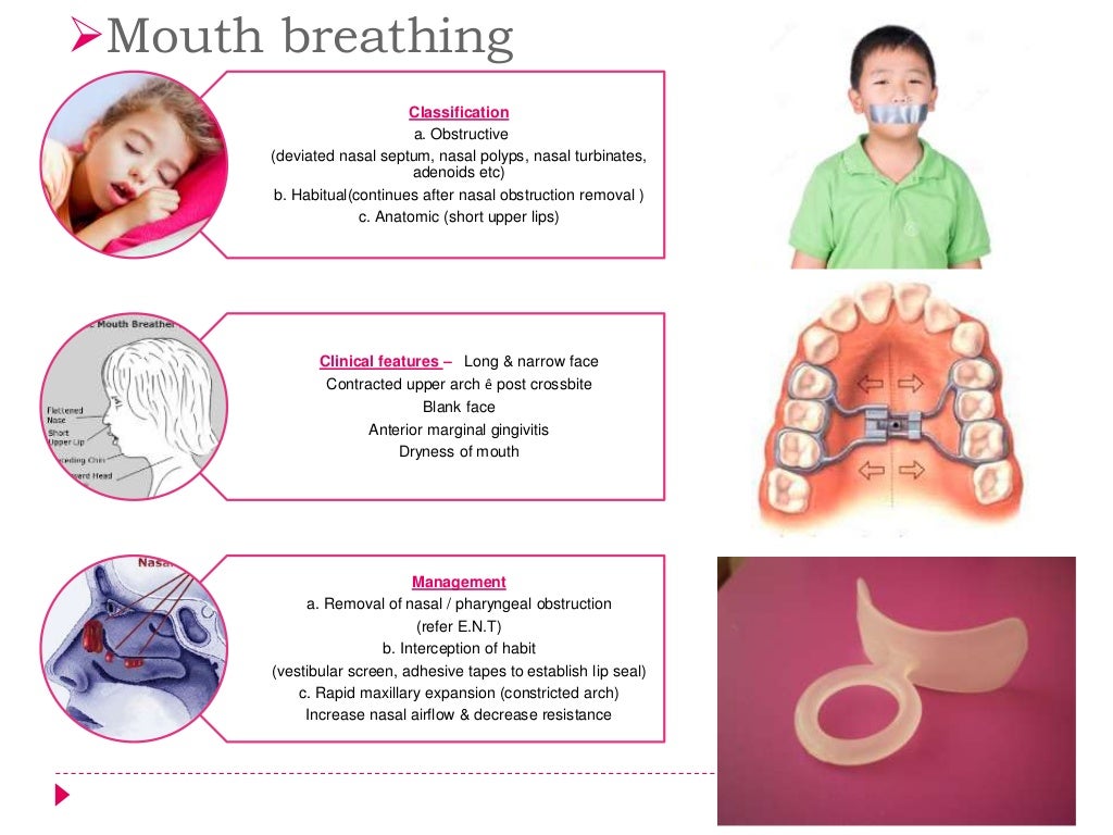 Interceptive orthodontics