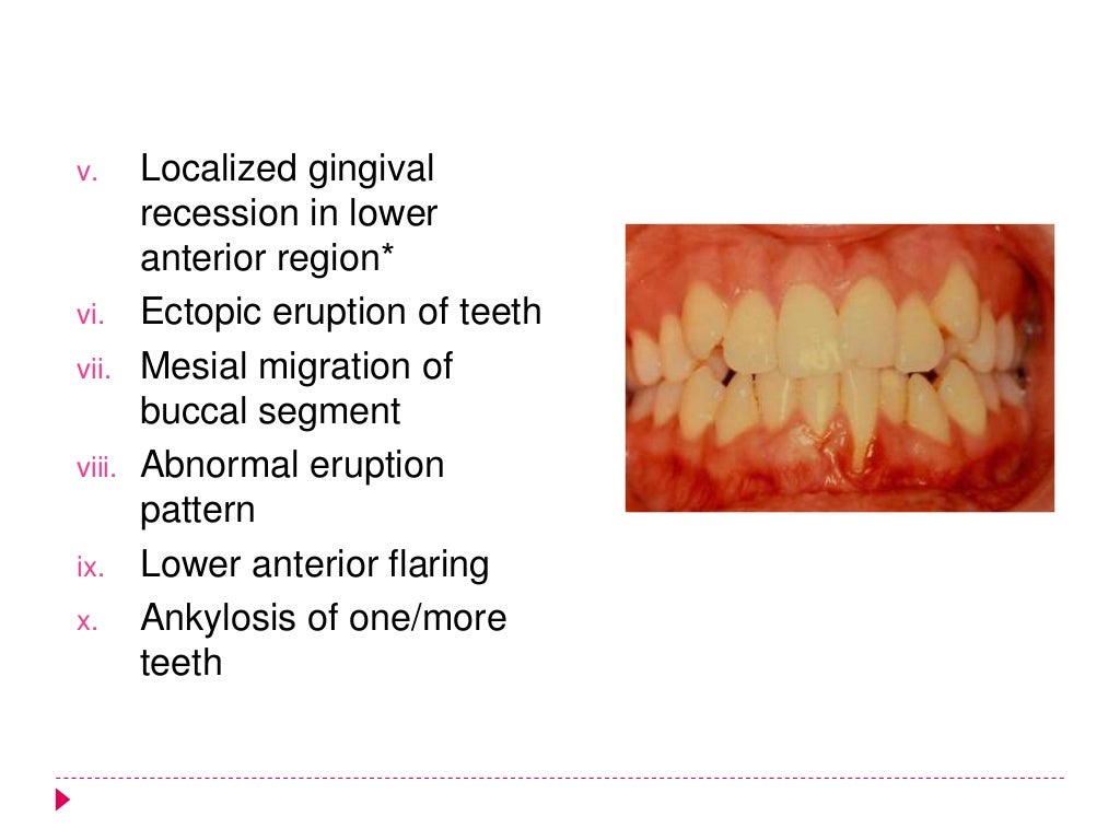 Interceptive orthodontics