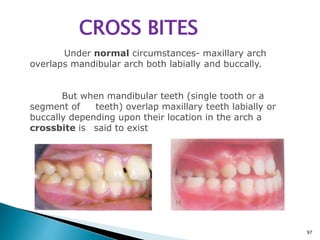 Interceptive orthodontics | PPTX