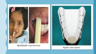 Interceptive orthodontics | PPTX