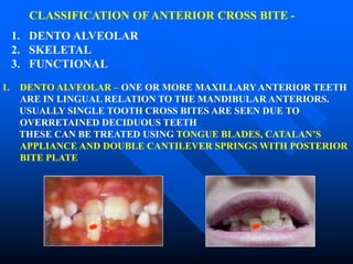 CLASSIFICATION OF ANTERIOR CROSS BITE -
1. DENTO ALVEOLAR
2. SKELETAL
3. FUNCTIONAL
1. DENTO ALVEOLAR – ONE OR MORE MAXILLARYANTERIOR TEETH
ARE IN LINGUAL RELATION TO THE MANDIBULAR ANTERIORS.
USUALLY SINGLE TOOTH CROSS BITES ARE SEEN DUE TO
OVERRETAINED DECIDUOUS TEETH
THESE CAN BE TREATED USING TONGUE BLADES, CATALAN’S
APPLIANCE AND DOUBLE CANTILEVER SPRINGS WITH POSTERIOR
BITE PLATE
 