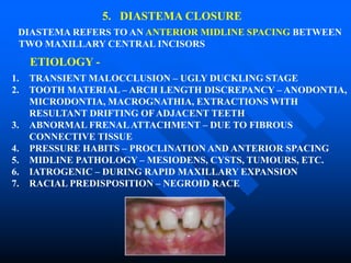 5. DIASTEMA CLOSURE
DIASTEMA REFERS TO AN ANTERIOR MIDLINE SPACING BETWEEN
TWO MAXILLARY CENTRAL INCISORS
1. TRANSIENT MALOCCLUSION – UGLY DUCKLING STAGE
2. TOOTH MATERIAL – ARCH LENGTH DISCREPANCY – ANODONTIA,
MICRODONTIA, MACROGNATHIA, EXTRACTIONS WITH
RESULTANT DRIFTING OF ADJACENT TEETH
3. ABNORMAL FRENALATTACHMENT – DUE TO FIBROUS
CONNECTIVE TISSUE
4. PRESSURE HABITS – PROCLINATION AND ANTERIOR SPACING
5. MIDLINE PATHOLOGY – MESIODENS, CYSTS, TUMOURS, ETC.
6. IATROGENIC – DURING RAPID MAXILLARY EXPANSION
7. RACIAL PREDISPOSITION – NEGROID RACE
ETIOLOGY -
 