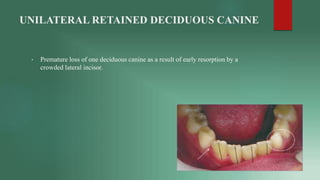 • Noar J. Review: Interceptive Orthodontics (2002). The European Journal of Orthodontics.
2020;24(6):705-705.
• Rubin RL, ...