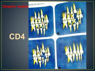 INTERCEPTIVE ORTHODONTICS.pptx