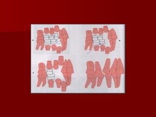 Interceptive Images interceptiveorthodontics-230613160948-c9368825.ppt