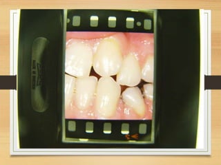 interceptive orthodontics applications.ppt