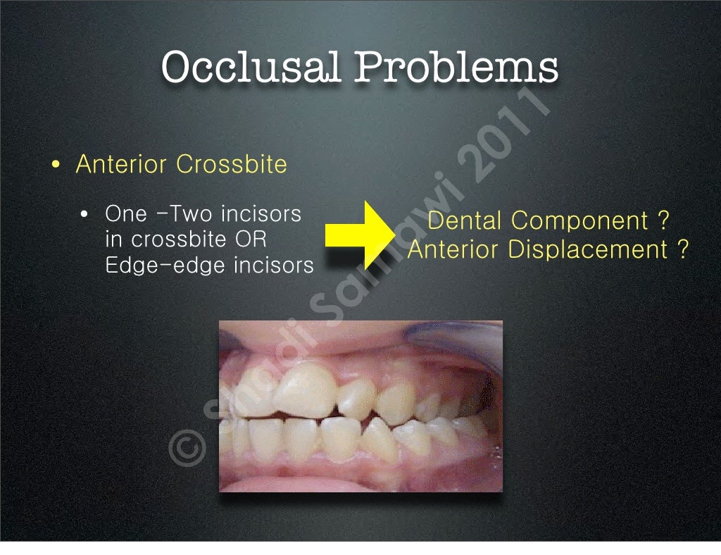 Interceptive Orthodontics