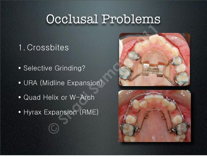 Interceptive Orthodontics