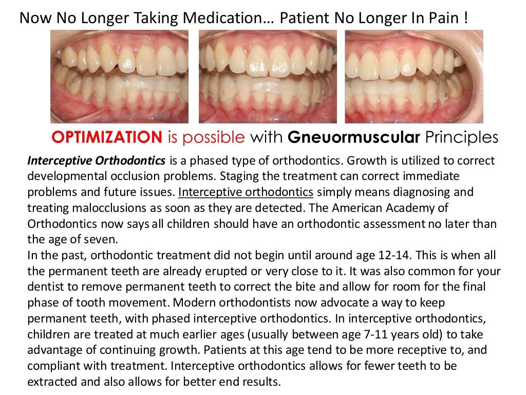 Interceptive orthodontic treatment