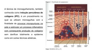 A técnica de microagulhamento, também
conhecida como indução percutânea de
colágeno (IPC), é um procedimento no
qual se utilizam microagulhas com a
finalidade de provocar micropunturas na
pele e estimular um processo inflamatório
com consequente produção de colágeno
sem danificar totalmente a epiderme
como em outras técnicas ablativas.
 
