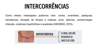 Como efeitos indesejados podemos citar: cortes, arranhões, petéquias,
hematomas, ativação de herpes e rosácea, acne, edemas, contaminação,
infecção, cicatrizes hipertróficas e queloides (NEGRÃO, 2015).
INTERCORRÊNCIAS
 