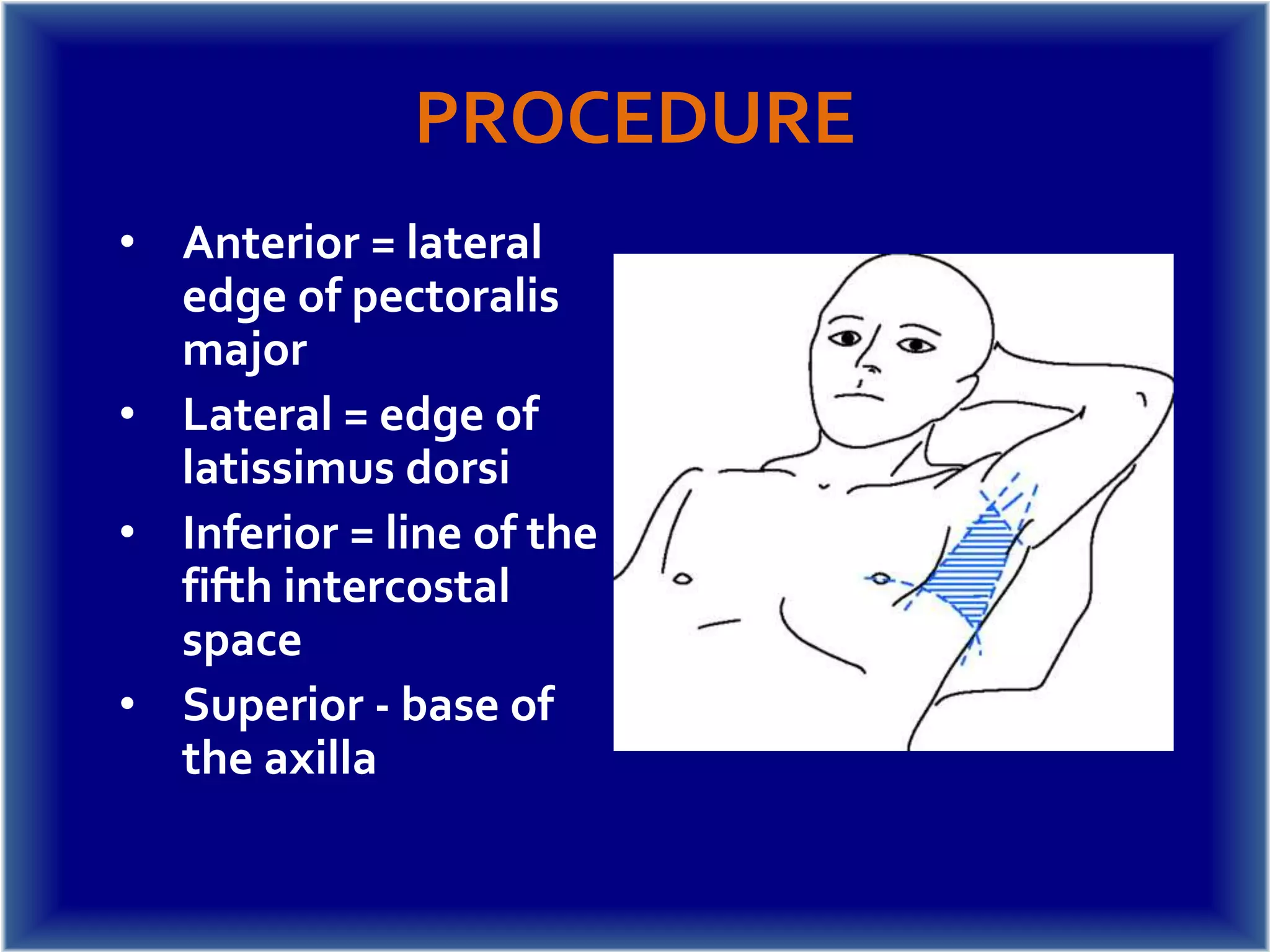Intercostal catheter insertion PPT