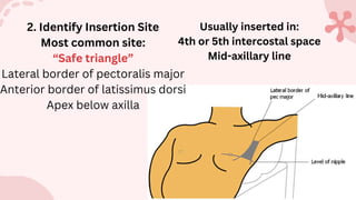 Comprehensive Guide to Intercostal Drainage: Procedure, Types, and Care ...