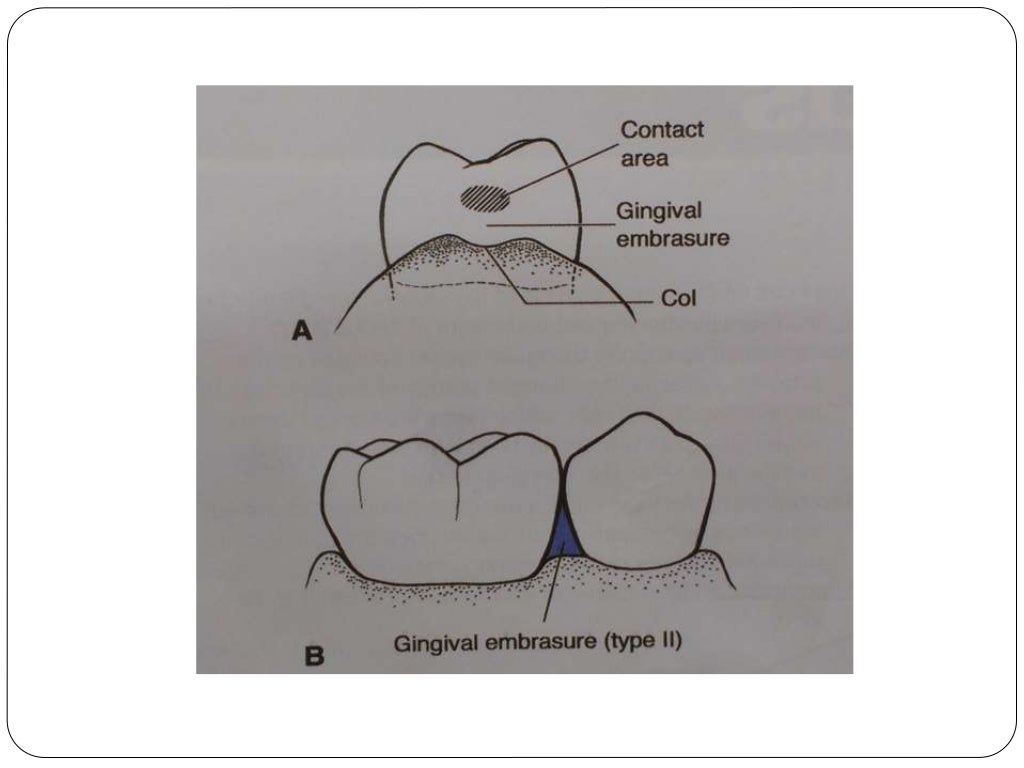 Interdental aids powerpoint presentation