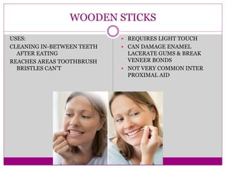 WOODEN STICKS
USES:
CLEANING IN-BETWEEN TEETH
AFTER EATING
REACHES AREAS TOOTHBRUSH
BRISTLES CAN’T
 REQUIRES LIGHT TOUCH
 CAN DAMAGE ENAMEL
LACERATE GUMS & BREAK
VENEER BONDS
 NOT VERY COMMON INTER
PROXIMAL AID
 