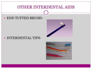 OTHER INTERDENTAL AIDS
 END TUFTED BRUSH-
 INTERDENTAL TIPS-
 