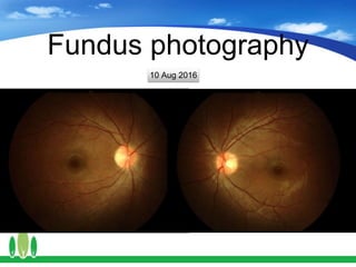 Fundus photography
10 Aug 2016
 