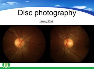 Disc photography
10 Aug 2016
 