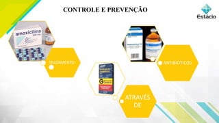 CONTROLE E PREVENÇÃO
TRATAMENTO
ATRAVÉS
DE
ANTIBIÓTICOS
 