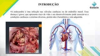 INTRODUÇÃO
•A endocardite é ima infecção nas válvulas cardíacas ou do endotélio mural. Essa
doença é grave, que apresenta risco de vida e seu desenvolvimento pode associar-se a
condições cardíacas e externas diversas, porém não é hereditária e sim adquirida.
 