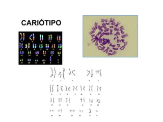 CARIÓTIPO
 