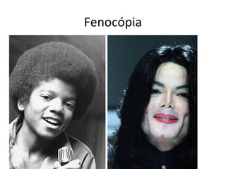Fenocópia
 