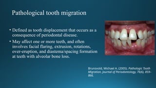 Pathological Tooth INTERDISCIPLINARY (1).ORTHDONTICS RELATED TO ENDODONTICS | PPTX