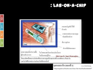 Ȩโน๶ทคโนโลยีชวภาพ : Lab-on-a-chip
              ี
               การพัฒนาอุปกรณปลอยอินซูลนอัตโนมัติและไบโอเซ็นเซอรแบบปลูกฝงใต
                                          ิ
    ผิิวหนัังใ
             ในการรัักษาผูปวยโรคเบาหวาน
                               โ
0

1

2

3
 
