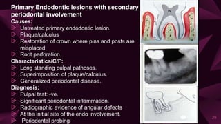 Primary Endodontic lesions with secondary
periodontal involvement
Causes:
⩥ Untreated primary endodontic lesion.
⩥ Plaque/calculus
⩥ Restoration of crown where pins and posts are
misplaced
⩥ Root perforation
Characteristics/C/F:
⩥ Long standing pulpal pathoses.
⩥ Superimposition of plaque/calculus.
⩥ Generalized periodontal disease.
Diagnosis:
⩥ Pulpal test: -ve.
⩥ Significant periodontal inflammation.
⩥ Radiographic evidence of angular defects
⩥ At the initial site of the endo involvement.
⩥ Periodontal probing
29
 
