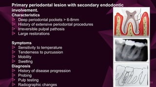 Primary periodontal lesion with secondary endodontic
involvement.
Characteristics
⩥ Deep periodontal pockets > 6-8mm
⩥ History of extensive periodontal procedures
⩥ Irreversible pulpal pathosis
⩥ Large restorations
Symptoms
⩥ Sensitivity to temperature
⩥ Tenderness to purcussion
⩥ Mobility
⩥ Swelling
Diagnosis
⩥ History of disease progression
⩥ Probing
⩥ Pulp testing
⩥ Radiographic changes
34
 